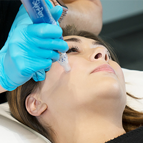 Woman laying back during microneedling session
