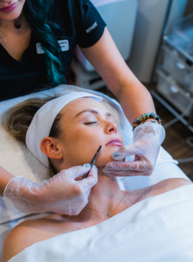 Carin-Dermaplaning-s