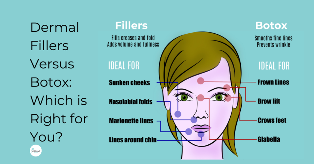 botox vs dermal fillers