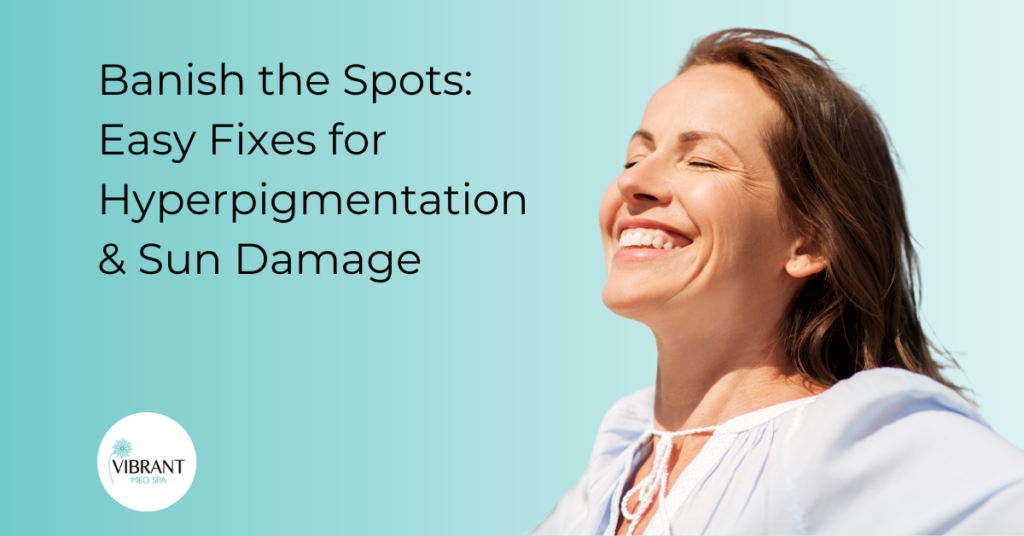Sun-spots-hyperpigmentation